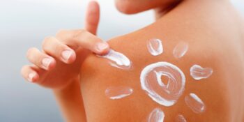 Toplanın Açıklıyoruz! Güneş Yanığı Kaç Günde Geçer, İz Kalır Mı?