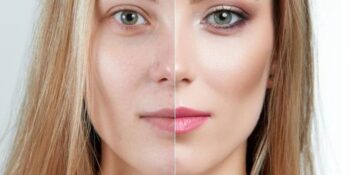 Estetik Yaptırmadan Daha Genç Görünmenin 5 Sırrı