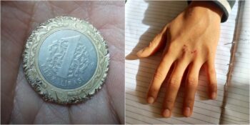 Okullarda Bir Salgın Gibi Yayılan Ve Ciddi Sağlık Sorunlarına Neden Olan Kanlı Para Oyunu Nedir?