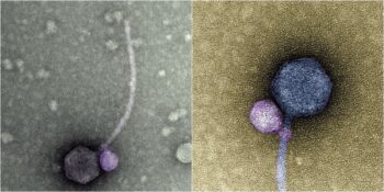 Bilim Dünyası Şaşkın! Diğer Virüsleri Isırarak Etkin Hale Gelen “Vampir Virüs” Keşfedildi