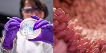 Bilim İnsanları İnsan Vücudunda Yaşayan Yeni Bir Yaşam Formu Keşfetti: Obelisk