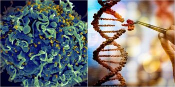 AIDS’te Yeni Tedavi Umudu: HIV Virüsünü Hücreden Ayıran Gen Düzenleme Teknolojisi Nedir?
