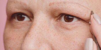 Kaş Dökülmesi Neden Olur, Kaş Dökülmesine Ne İyi Gelir?