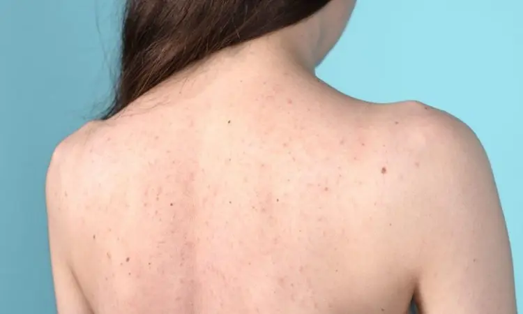 Dermatologist