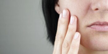 Kuru, Hassas Ve Atopik Cilde Sahip Olanlara Dermatologların Tavsiye Ettiği 10 Şey