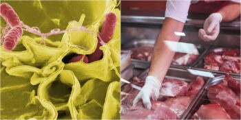 İzmir’de Bir Kadının Hayatını Kaybetmesine Neden Olan Salmonella Bakterisi Nedir, Nasıl Bulaşır?