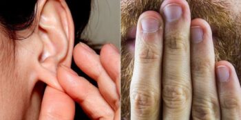 Uzmanlar Yanıtladı! Hıçkırık Neden Olur ve Nasıl Geçer?