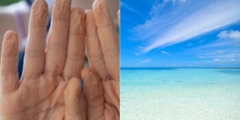Suda Uzun Süre Kaldığımızda Neden Sadece El ve Ayak Parmaklarımız Buruşur?