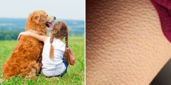 Tüylerinizin Diken Diken Olduğu Anların Bilimsel Bir Adı Var! Duyguların En Sıcak Hali Kama Muta Nedir?