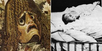 Ensefalit Lethargica: 20. Yüzyılın Başında Görülen Tarihin En Gizemli Uyku Hastalığı