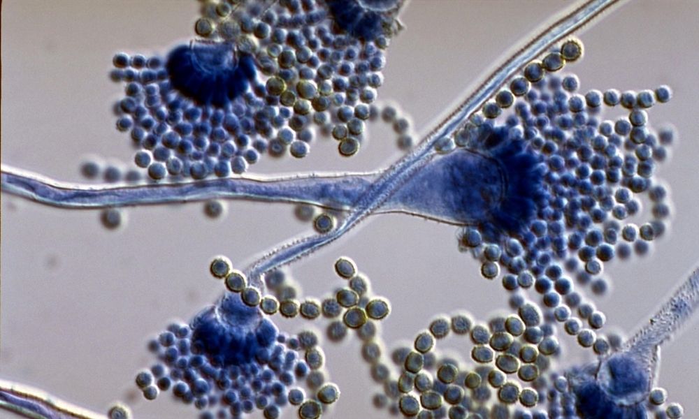 Aspergillus flavus