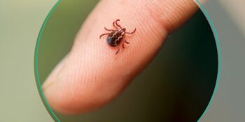 Yaz Aylarının En Büyük Sorunu: Kene Isırığı Nasıl Anlaşılır, Belirtileri Nelerdir?