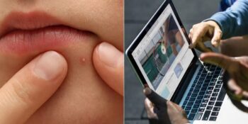 Cevap Beyinde Gizli! Neden Bazı İnsanlar Sivilce Sıkmayı Seviyor?