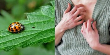 Bilim İnsanları Açıklıyor! Neden Böceklerden Bahsederken Kaşınmaya Başlıyoruz?