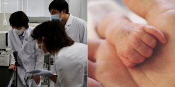 Araştırma: Yeni Gen Düzenleme Teknolojisiyle Down Sendromu Tamamen Tedavi Edilebilir