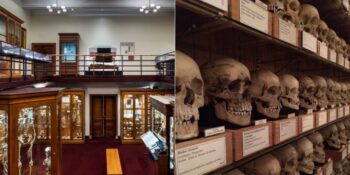 İnsan Bedeni, Hastalıklar Ve Bilimin Karanlık Yüzüne “Işık Tutan” Tartışmalı Mütter Müzesi