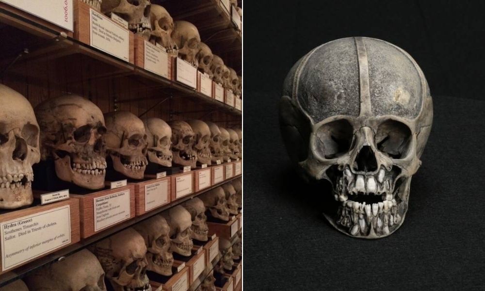 Mütter Müzesi