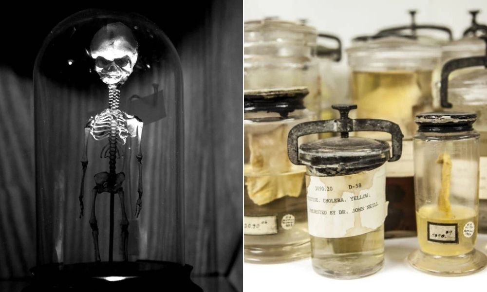 Mütter Müzesi