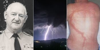 Roy Sullivan: Yedi Kez Yıldırım Çarpmasına Rağmen Hayatta Kalmayı Başaran Adam