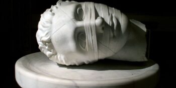 Akalkuli: Toplama ve Çıkarma Gibi Basit Matematik İşlemlerini Yapma Yeteneğindeki Bozukluk