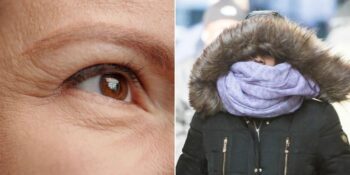 Kar Körlüğünden Kırışıklıklara: Kışın Vücudunuzda Meydana Gelen 14 Garip Şey