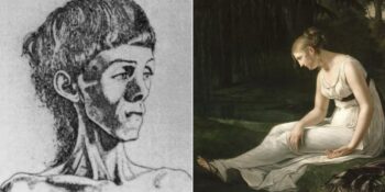 Diş Çürüğünden Damar Tıkanıklığına: Tarihte Zengin Hastalığı Olarak Bilinen 9 Sağlık Sorunu