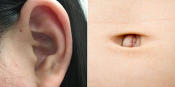 Çok Nadir Görülüyor! Bazı İnsanların Sahip Olduğu Birbirinden İlginç 9 Genetik Özellik