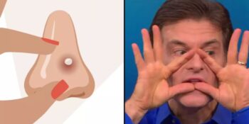 Uzmanlar Açıklıyor! “Ölüm Üçgeni”ndeki Sivilceleri Neden Asla Patlatmamalısınız?