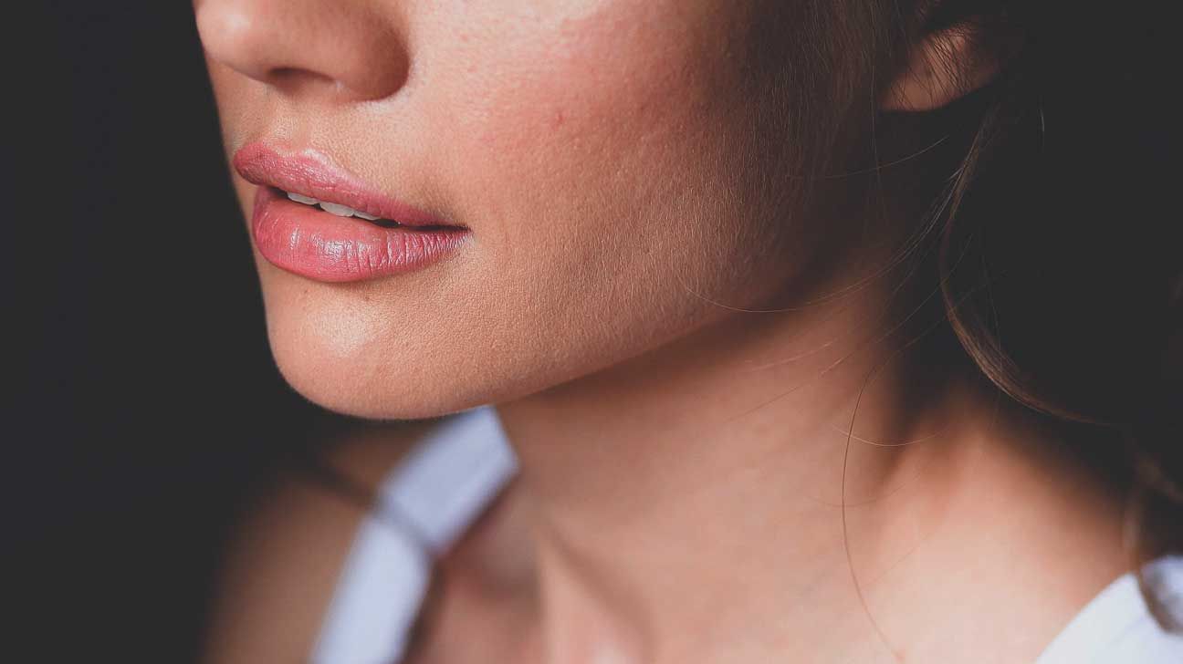 ölüm üçgeni sivilceleri