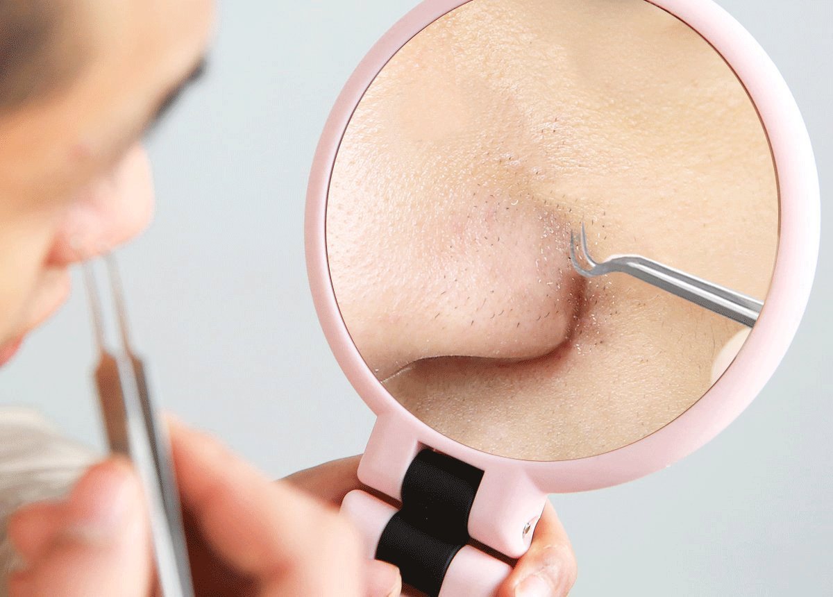 ölüm üçgeni sivilceleri