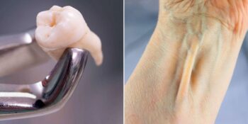 Yirmilik Dişlerden Longus Kasına: İnsanlarda Artık İşlevsiz Olduğu Düşünülen 10 Vücut Parçası