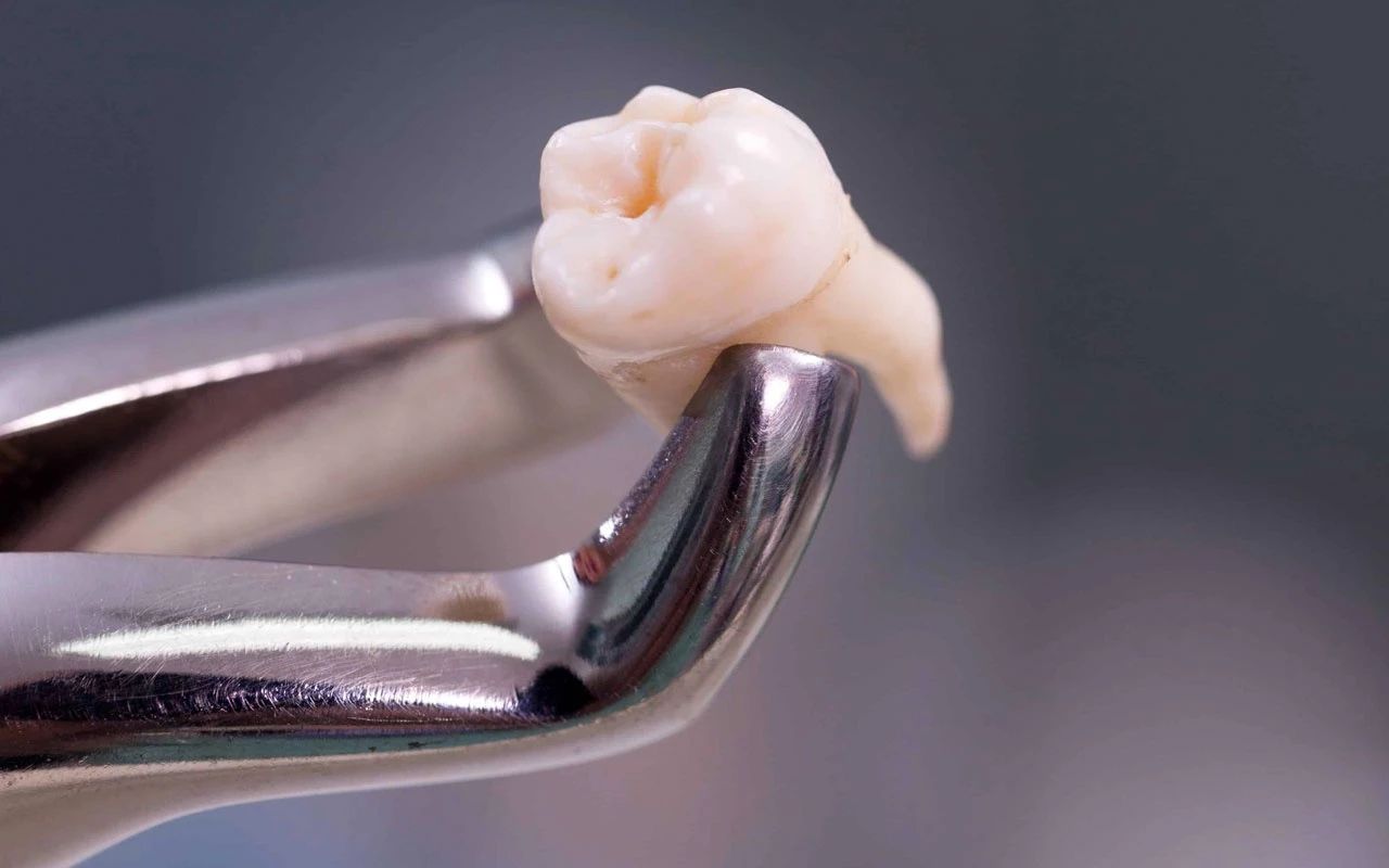 işlevsiz vücut parçaları