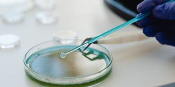 Bakteriden Protein Olur mu?